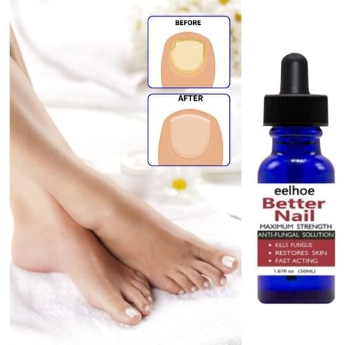 Nail Repair Serum Fungal Nail Treatment Essence Removal Onychomycosis Paronychia Anti Fungus Infection Toe Nail Nourishing Care