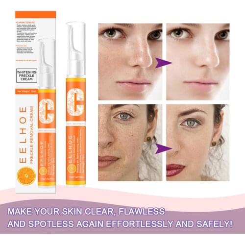 EELHOE Vitamin C Whitening Cream Instant Blemish Removal Gel Freckle Pigmented Melanin Spots Remove Pen Brighten Moisturizer