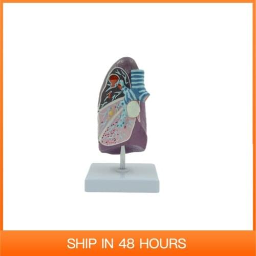 Diseased Human Lung Structure Respiratory System Model for Anatomical Study Display Teach Anatomy Medical Supply and Equipment