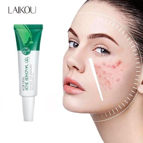Aloe Acne Treatment Gel Face Cream Serum Anti Acne Scar Cream Shrink Pores Moisturizing Oil Control Soothing Essence Skin Care