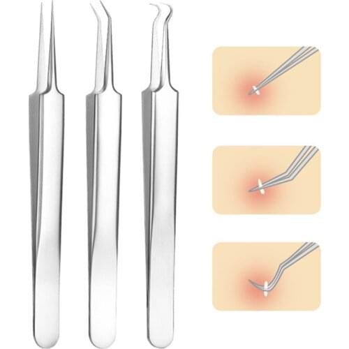 1Pc Blackhead Remover Tool Acne Remover Tool Clean Pimple Removal Tools Face Care Beauty Needles Tweezers Stainless Steel Clips