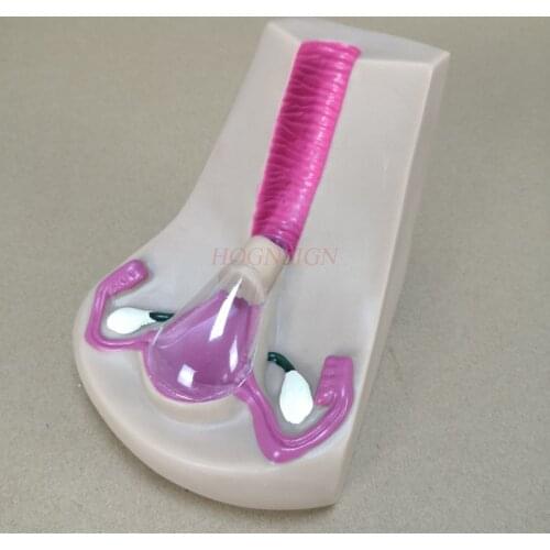 Female intrauterine contraceptive device and training model uterine reproductive organ teaching mold