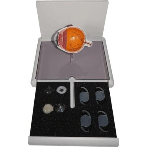 Cataract Eye Anatomy Model Medical Anatomical Teaching AIDS