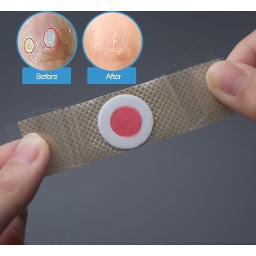 48pcs Foot Care Sticker Corn Removal Killer Medical Patch Calluses Plantar Warts Thorn Pain Relief Curative Patches Plaster