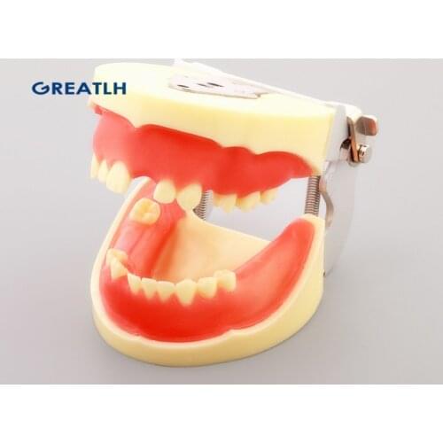 Dentistry Practice Implant Teeth Model Dental Teeth Models for Teeth Implant Practice Model Missing Teeth M2002