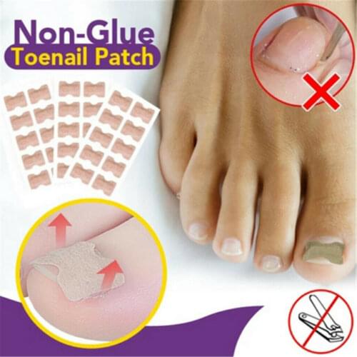 10/50Pcs Non-Glue Toenail Patch Ingrown Toenail Correction Pedicure Tool Nail Treatment Sticker Breathable Foot Care