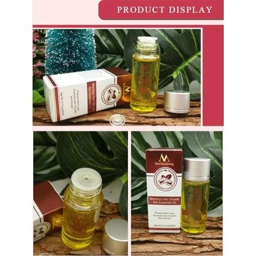 Natural Hair Loss Treatment Andrea Hair Growth Products Ginger Oil Hair Growth Faster Grow Hair Ginger Shampoo Stop