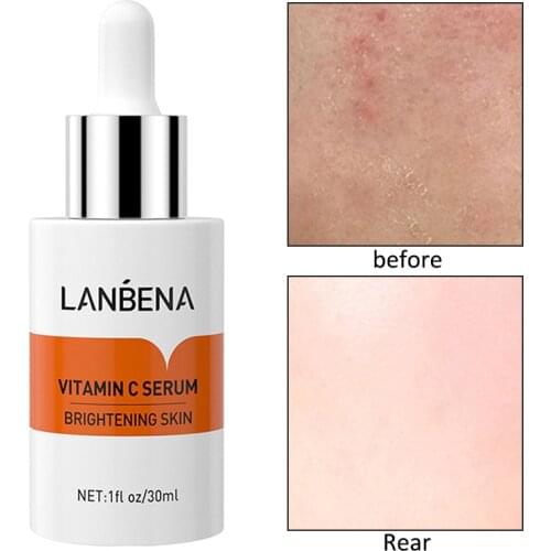 Soothing Skin Shrink Pores Face Serum Moisturizing Repairing Anti-Aging Remove Wrinkle Fine Lines Acne Treatment Essence TSLM1