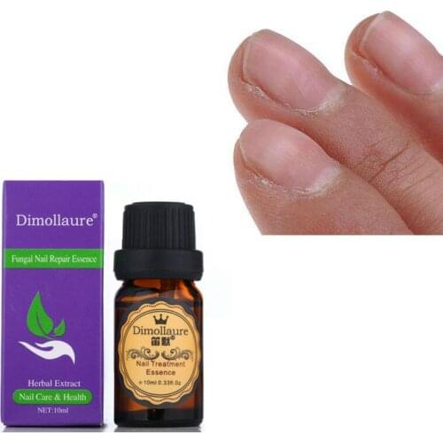 Dimollaure Fungal Nail Treatment Essence Hand Foot Toe Nail Fungus Removal Gel Anti Infection Gel Onychomycosis