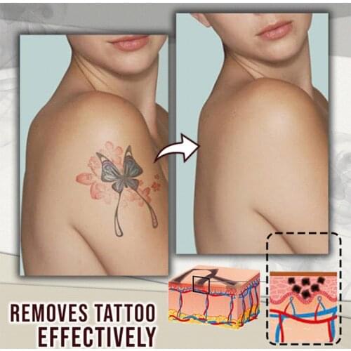 Tattoo Removal Cream Painless Remove Tattoo Ink Remover Without Scarring No Hurt Safe Gentle RP