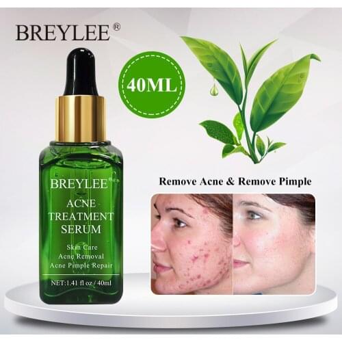 BREYLEE Acne Treatment Face Serum Facial Essence Removal Scar Cream Anti Acne Pimple Whitening Remover Acne Skin Care 40ml