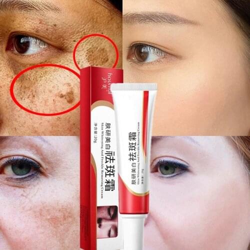 20g Effective Whitening Cream Face Moisturizer Whitening And Anti-Freckle Cream Cream To Lighten Spots Face Cream Smoothing