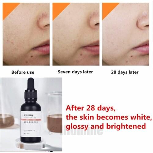 Astaxanthin Essence 30ml Antioxidant Anti-aging Refreshing Absorbable Moisturizing Non Greasy