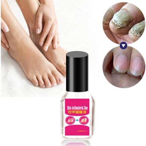4ml Nail Repair Liquid Essence Quick Effect Nail Fungal Treatment Manicure Tools Pedicure Treatment Gel Feet Care Essence