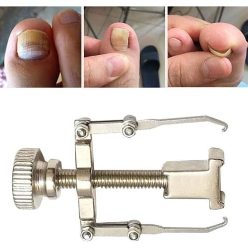 Ingrown Toenail Toe Fixer Recover Correction Device Pedicure Foot Nail Care Tool Protector Tool Pedicure Foot Nail Care
