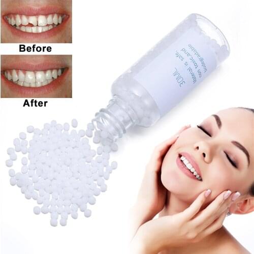 10ml /30ml Temporary Tooth Filling Solid Material Replace Missing Repair Solid Denture Adhesive Glue Oral Cavity DIY Kit