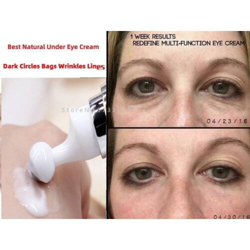 Best Natural Under Eye Cream Dark Circles Bags Wrinkles Lines Lift Puffiness 10ml
