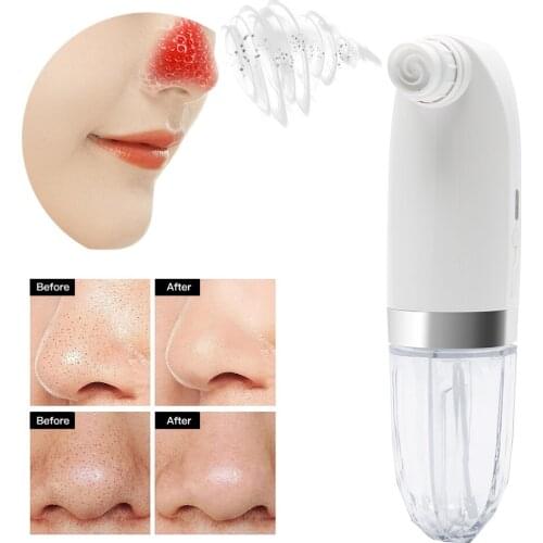 Electric Blackhead Remover Vacuum Pore Cleaner Water Cycle Acne Pimple Removal Facial Deep Cleansing Beauty Care Machine