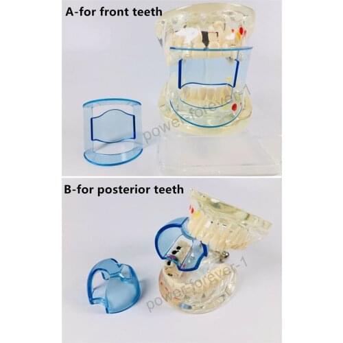 10Pis Dental Mouth Gag Props Front Teeth Opener Cheek Retractor Part Anterior/Posterior Transparent Blue