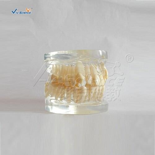 Orthodontic Model dental teeth model with metal&half ceramic bracket