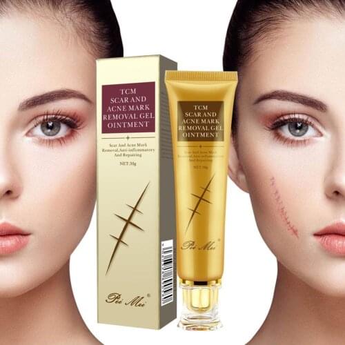 Repairing Acne Scar Removal Cream Gel Face Pimples Body Moisturizing Stretch Pregnancy Section Care Skin Cesarean Marks Cre P6Y1