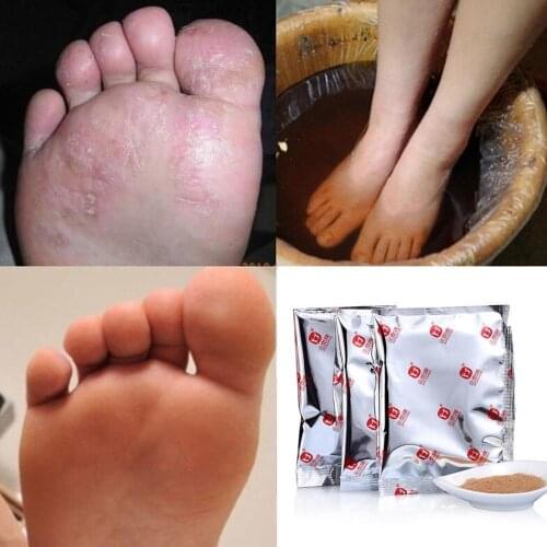 Foot Bath Powder Anti Beriberi Feet Care Athletes Foot Foot Odor Sweat Itching Peeling Beriberi