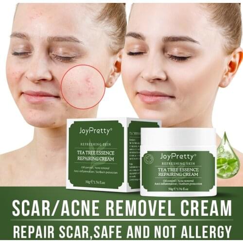 Oil control anti-acne shrinking pores whitening acne cream skin care effective tea tree oil acne cream 50ml