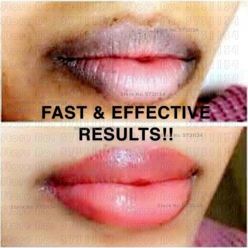 BEST EXTREME LIGHTENING PINK lip scrub solution,permanent pink lip,dark lip corrector