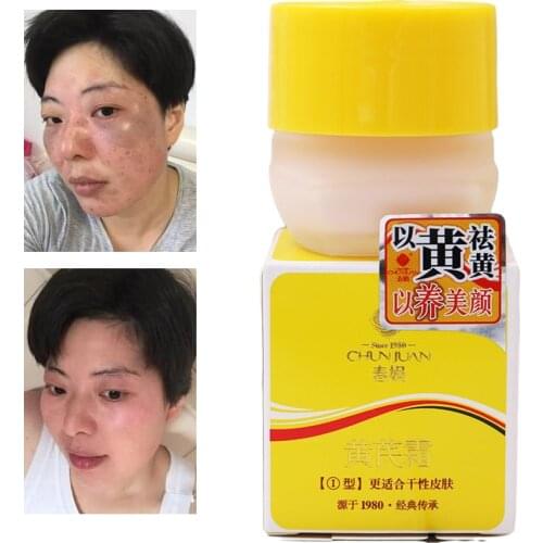 Chinese Medicine Astragalus Whitening Remove Dark Spots Facial Cream Repair Fade Freckls Melanin Remover Brighten Skin