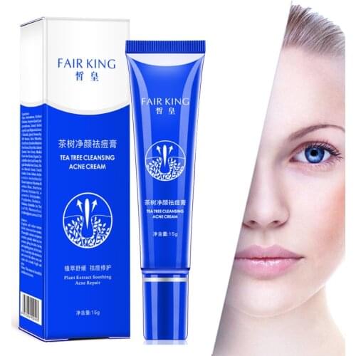 Acne Treatment Face Cream Remove Acne Scar Mark Whitening Oil Control Shrink Pores Cream Blackhead Repair Cleaning Skin Care