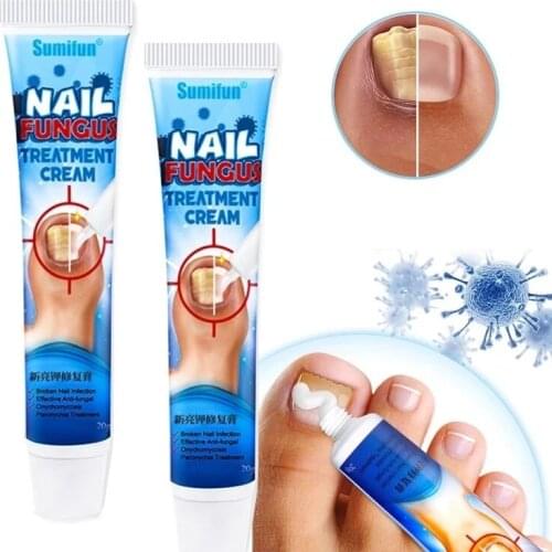 5pcs Nail Fungus Removal Cream Onychomycosis Fungal Nail Treatment Paronychia Anti Infection Feet Toe Fungal Nail Care Ointment