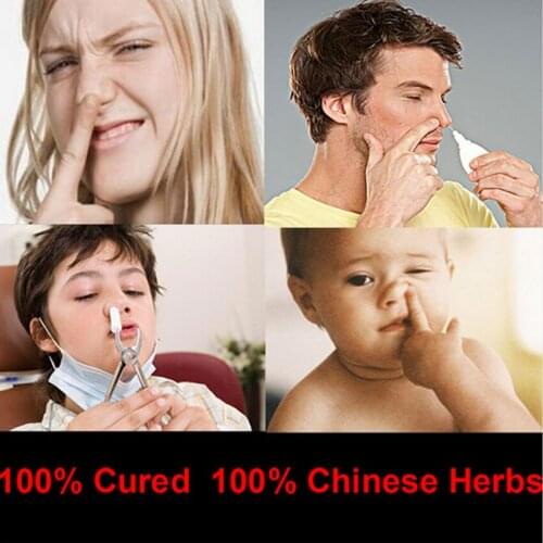 Chinese Medicine Treatment Rhinitis Spray Sinusitis Nasal Congestion Itchy Runny Nose Allergic Rhinitis Spray