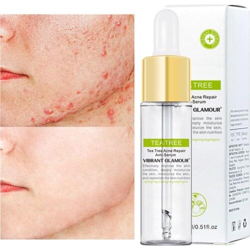 Vitamin C Whitening Face Serum Skin Care Hyaluronic Acid Cream Fade Dark Spots Remover Acne Treatment Anti-Aging 15ml/30ml