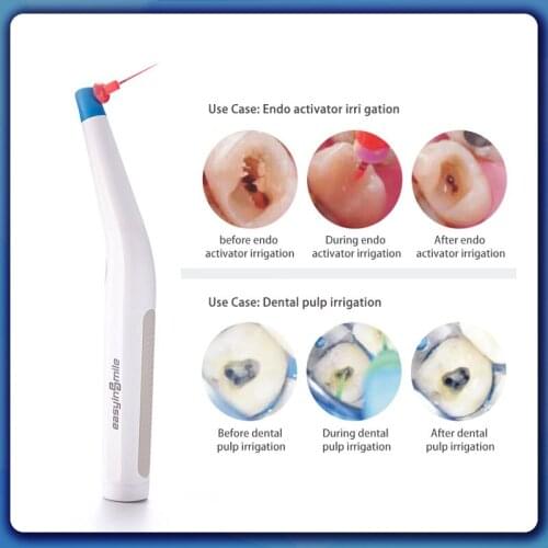 Root Canal Sonic Irrigator Activator With 60 Pcs Endo Files For Endodontic Cleaning Dentistry Equipment Tools With 60 Tips