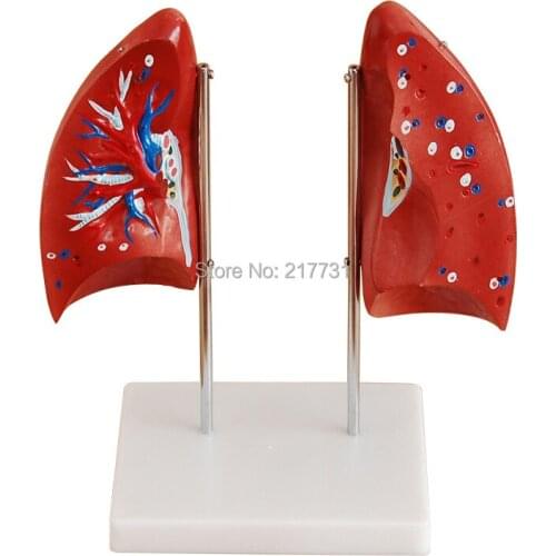 Lung Anatomy Model Of Human Anatomy Model Of Pulmonary Teaching Special Training Model, Massage Referance