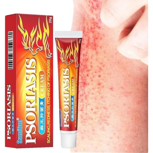Sumifun 20g Itchy Skin Cream For Stretch Scar Psoriasis Cream Antibacterial Antipruritic Anti-icth Cream Skin Care