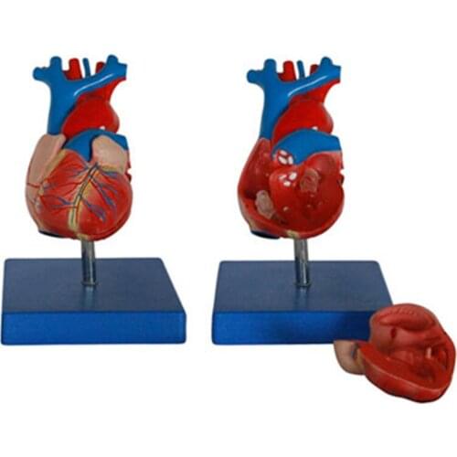 A new model of natural large heart anatomy