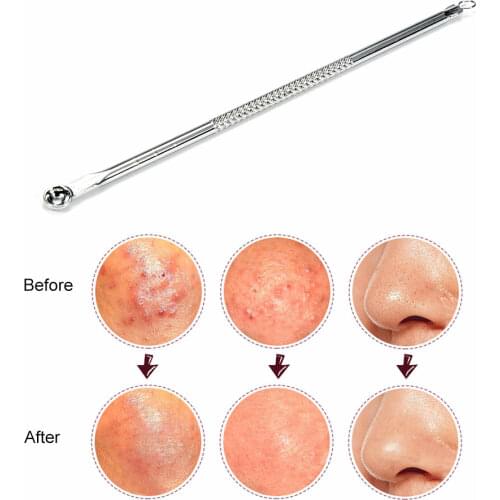1pc Face Pimple Removal Tools Antibacterial Blackhead Acne Needle Clip Tweezer Kit Face Skin Care Tool For All Skin Type