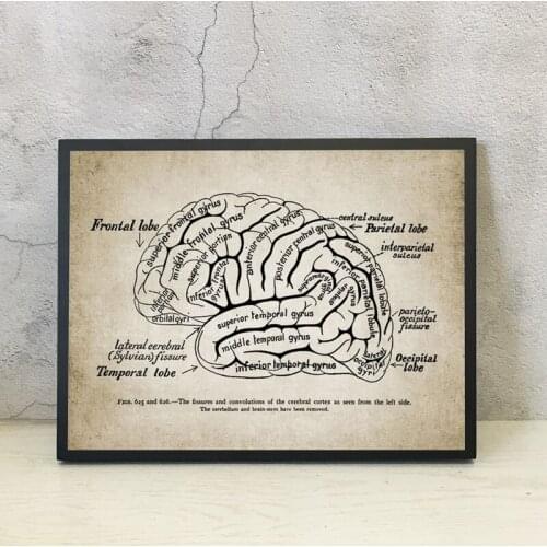 Nordic Print People Brain Anatomy Illustration Vintage Poster Art Canvas Painting Doctor Office Wall Artwork Decor Medicine Gift