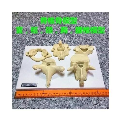 The human spine model (atlas, neck, chest, lumbar model) biomedical teaching apparatus.free