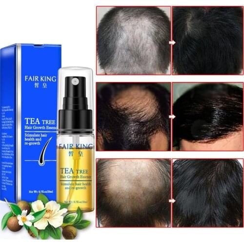 Tea Tree Nourishing Hair Growth Essence Treatment Preventing Hair Loss Elastic Oil Anti Lose Hair Care Make Hair Smoother Oil