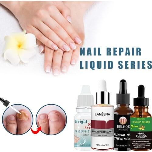 10/15/20/30/50 ML Nails Repair Liquid Effective Anti-fungal Remove Onychomycosis Nourishing Foot Nail Care Disinfection Serum