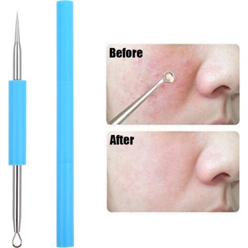 1PC Face Skin Care Acne Needle Stainless Steel Blackhead Comedone Acne Removal Blemish Pimple Extractor Pore Clean Beauty Tools