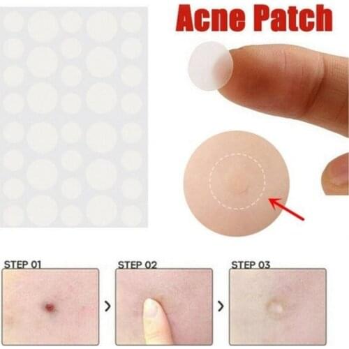 36pcs Warts Remover Patch Skin Tags Remover Warts Treatment Cream Herbal Extract Foot Corn Plaster Acne Warts Stickers