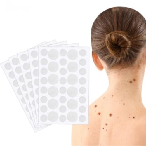 36/72/108Pcs Warts Remover Patch Skin Tags Remover Warts Treatment Cream Herbal Extract Foot Corn Plaster Acne Warts Stickers