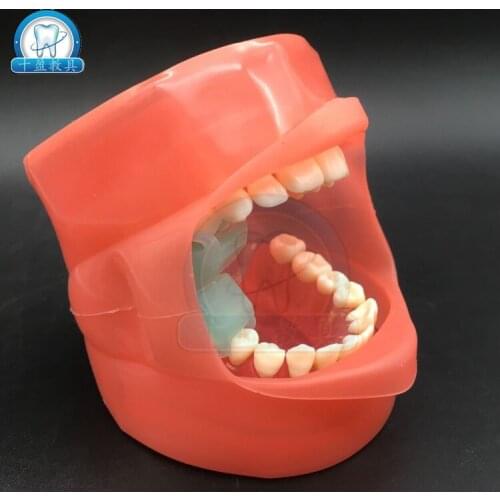 Dental Stomatology Teaching Model Extractable Teeth Demolition Teeth Simulation model