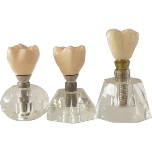 Dental Practice Implant Teeth Model with Clip Attachment Anatomically Bone Mandible Sinus Lifting Model Edentulous Model