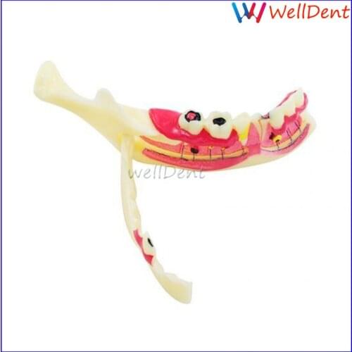 Dental Teeth Model Mandibular Study Teach Model Demonstration Anatomical Model Patient Orthodontic Braces Tissue Teeth