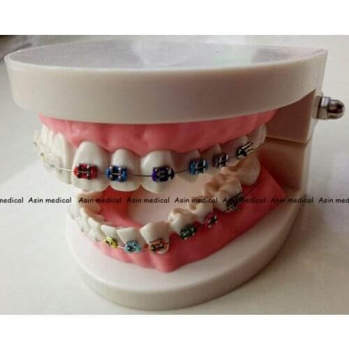 2017 New Orthodontics Model for Dentist Dental 1/2 Standard Dentition with half Metal Brackets half ceramic bracket Teeth Model