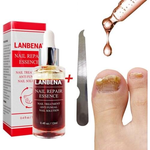 Hot sale 12ml Nail Fungal Treatment With File Anti Fungus Onychomycosis Removal Nails Care Repair Liquid FRE